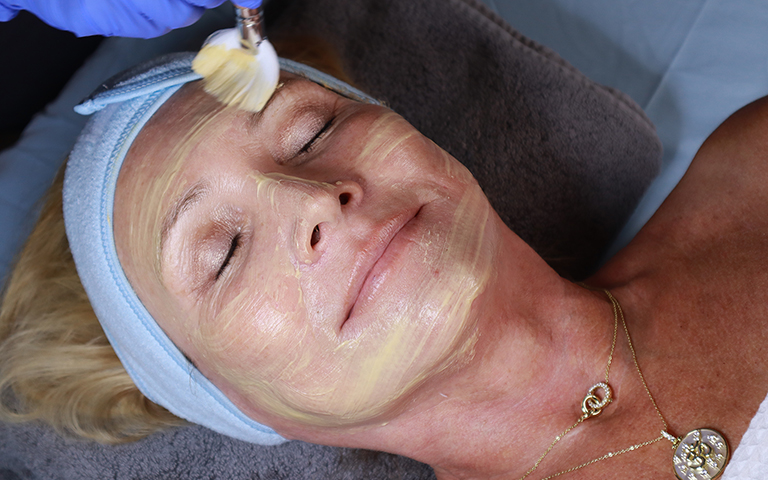 Woman getting a facial at RENEW by RJ in Temecula, CA